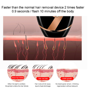 Beauty laser hair removal machine professional whitening