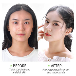 Matcha Exfoliating Peeling Gel Facial Scrub