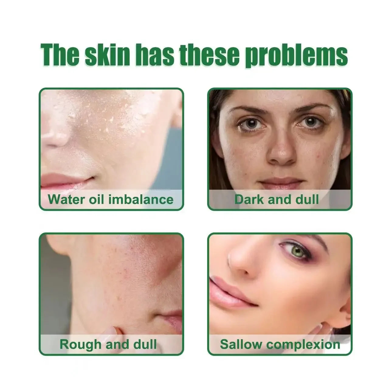 Acne Facial Serum Pore Shrinking Skin Care Pimple Spots Remover