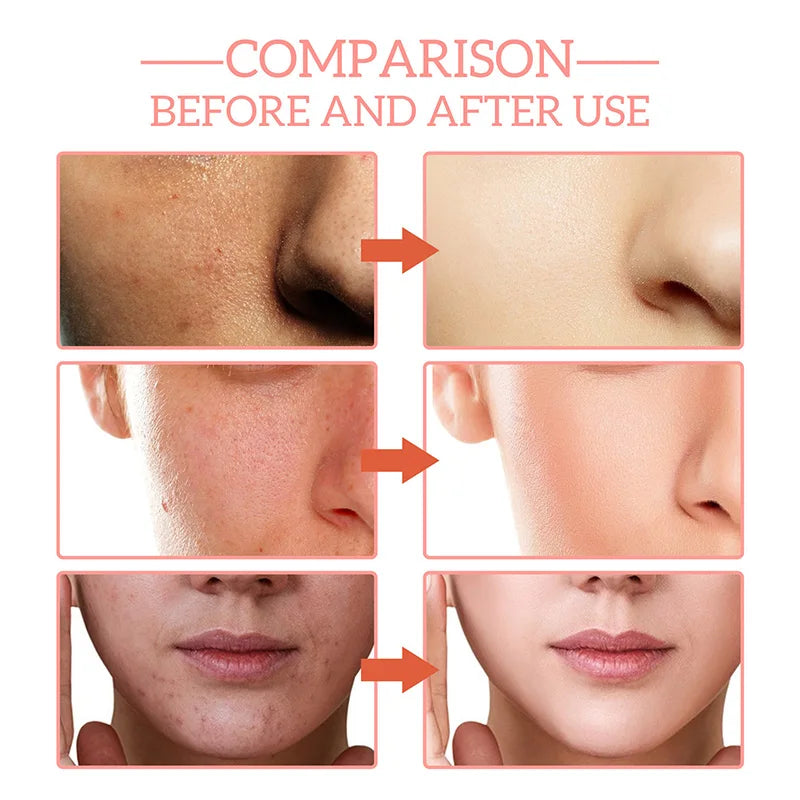 Hyaluronic 5 In 1 Face Serum Acid Moisturizing Whitening Anti Wrinkle Aging