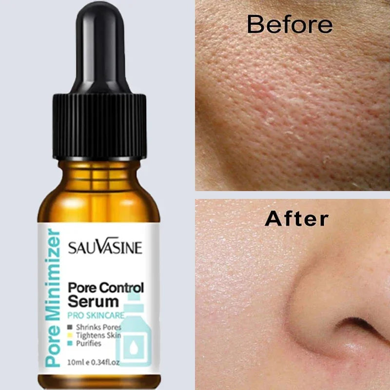 Removing Large Pores Pore Shrinking Serum Face Tightening.