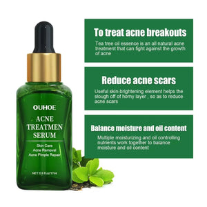 Acne Facial Serum Pore Shrinking Skin Care Pimple Spots Remover