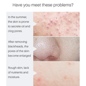 Removing Large Pores Pore Shrinking Serum Face Tightening.